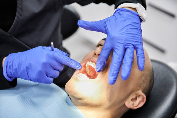 Best Knocked-Out Tooth (Avulsed Tooth) Treatment in Ardsley, NY