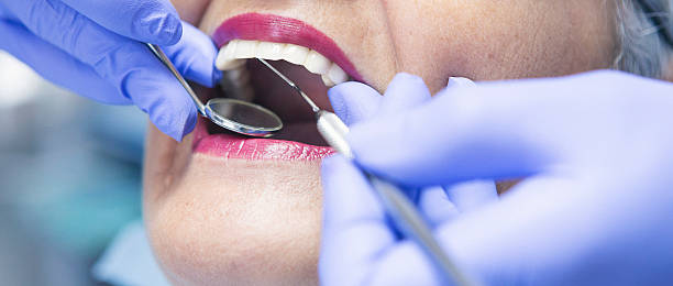 Best Dental Abscess Treatment in Ardsley, NY
